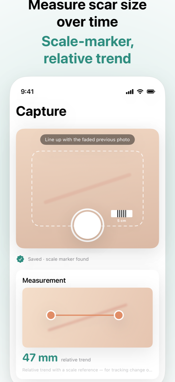 Guided capture with scale-marker measurement