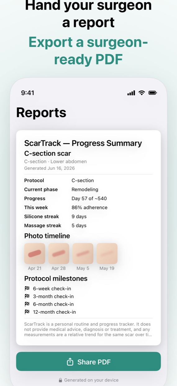 Surgeon-ready PDF report